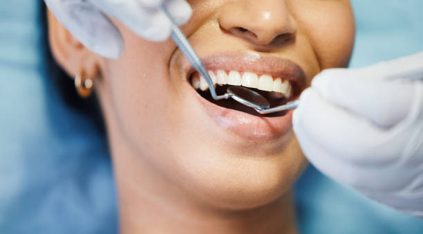 Best Emergency Dental Care for Broken or Chipped Teeth in Highland Lakes, NJ