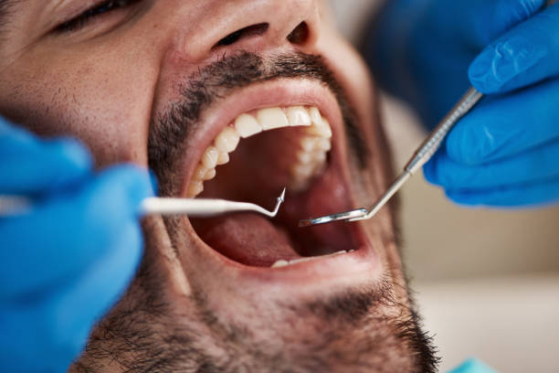 Best Emergency Treatment for Dental Infections or Abscesses in Highland Lakes, NJ